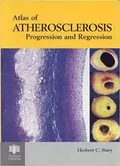 An Atlas of Atherosclerosis Progression and Regression: 