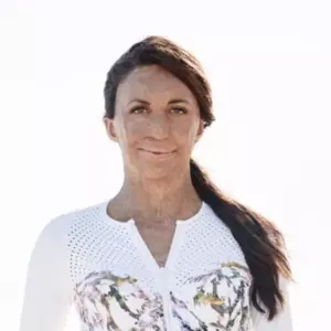 Turia Pitt Turia Pitt